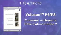 Nettoyage filtre P6-P8 Tips & Tricks FR