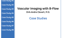 Vascular Imaging with B-Flow