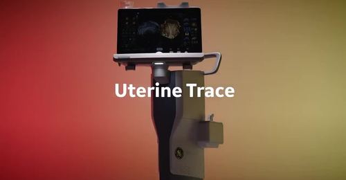 Uterine Trace - Voluson SWIFT – Dr. Menkhaus