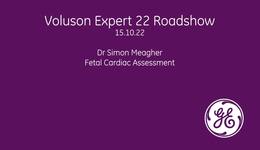 Voluson Expert 22 Roadshow-Dr Meagher-Fetal Cardiac