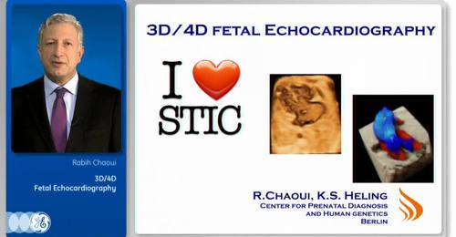 VISUS 2015: Chaoui: 3D/4D Fetal Echocardiography