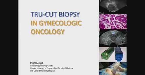 Tru-Cut Biopsy in Gynecologic Oncology