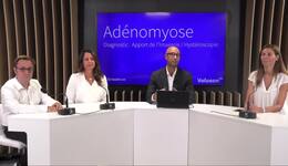Replay Webinar – Diagnostic de l'adénomyose : apports de l'imagerie (échographie/IRM pelvienne) et de l'hystéroscopie
