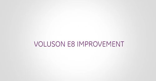 Dr. Benoit: Voluson E8 Improvement