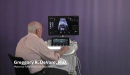 Voluson Fetal Heart - fetalHQ Case Study - Normal Heart with Dr. DeVore