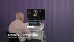 Voluson Fetal Heart - fetalHQ Case Study - Pulmonary Stenosis with Dr. DeVore