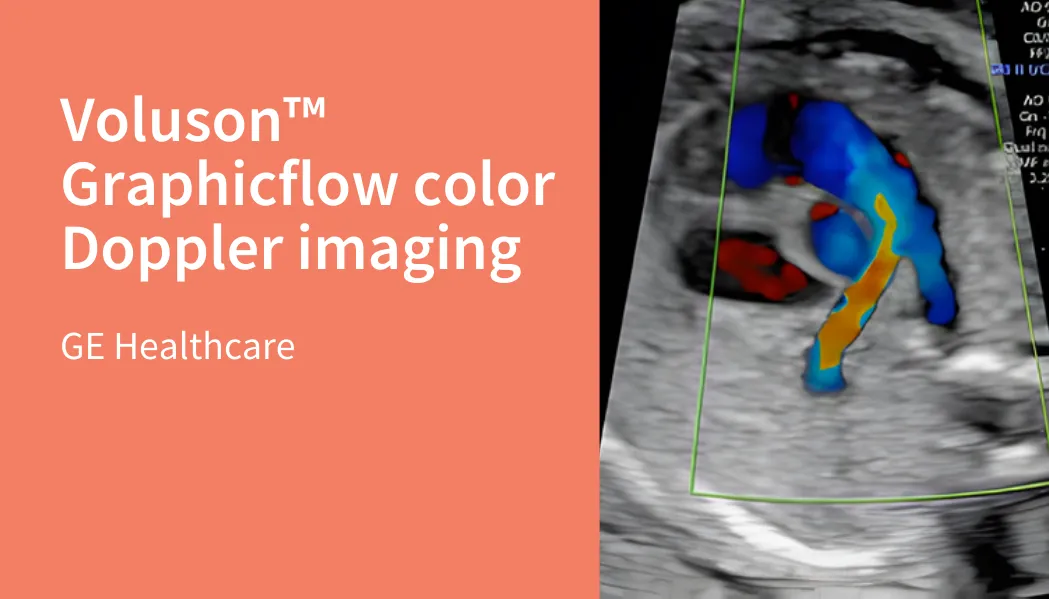 Voluson™ Graphicflow color Doppler imaging