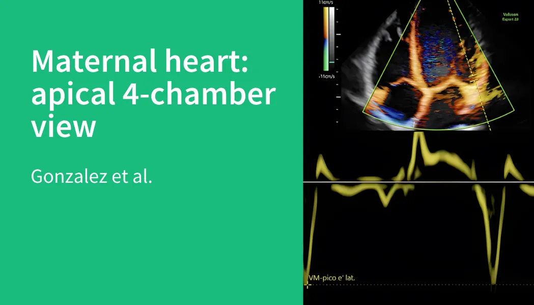 Maternal heart imaging – Apical 4-chamber