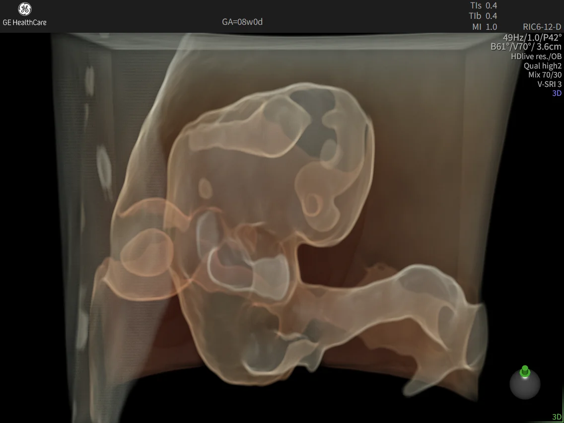 8 week embryo with HDlive