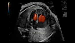 Fetal Cardiac Screening Echo Course