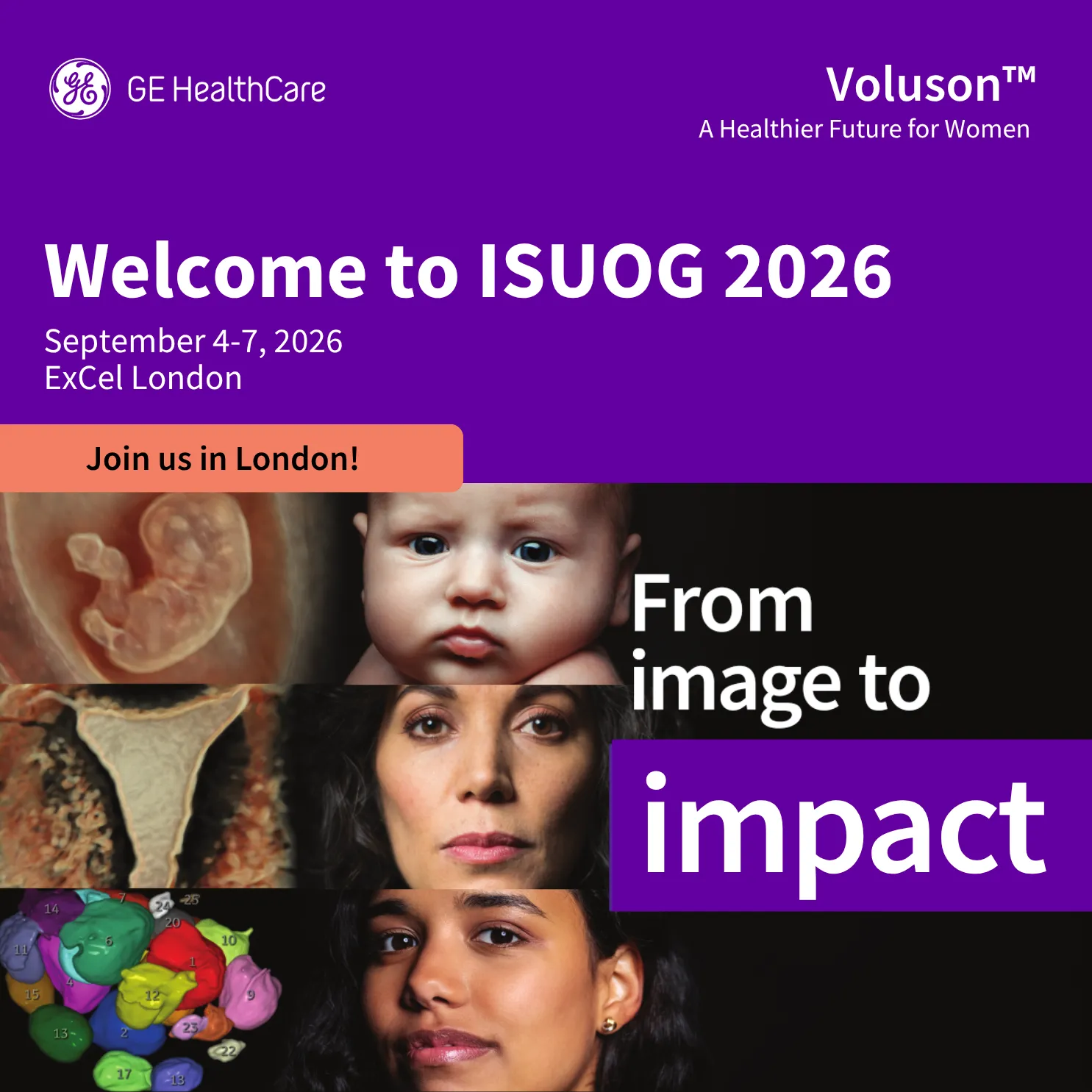 ISUOG Congress 2026