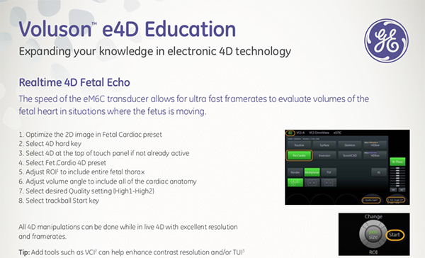 Voluson Real-Time 4D Fetal Echo QuickCard (BT17)